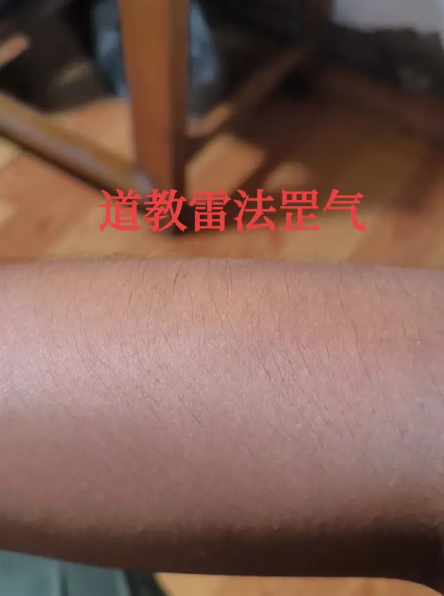 雷炁